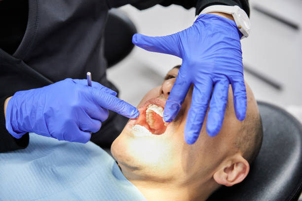 Best Emergency Dental Extractions in Georgetown, CA